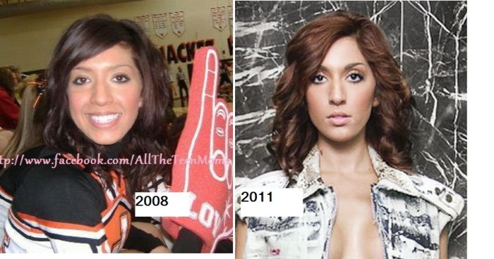 Farrah Abraham Goes Under the Knife Again -- See Her New Boobs!