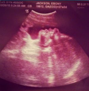 James posted one of Ebony's sonogram photos...